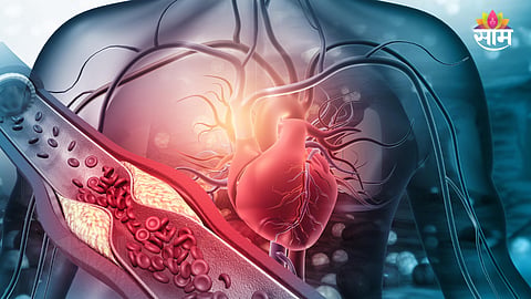 Second heart attack symptoms
