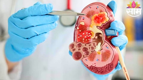 CKD symptoms