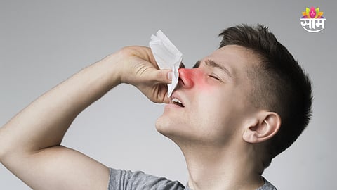 Nose Bleeding