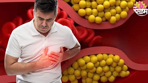 high cholesterol