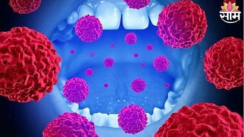 Mouth Cancer Causes