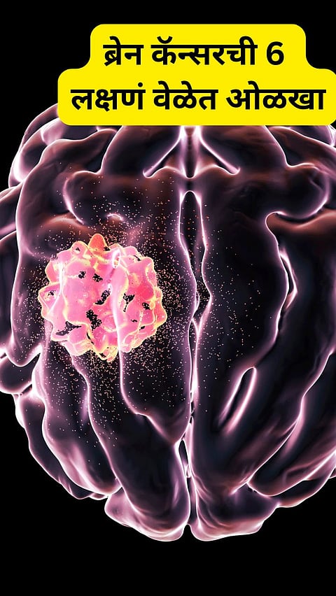 Early brain tumor symptoms