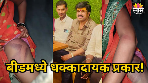 BEED HORROR: WOMAN BRUTALLY ASSAULTED FOR OPPOSING GAMBLING DEN IN RANJEGAON