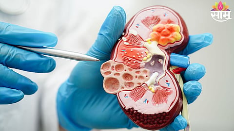 Kidney Damage Symptoms