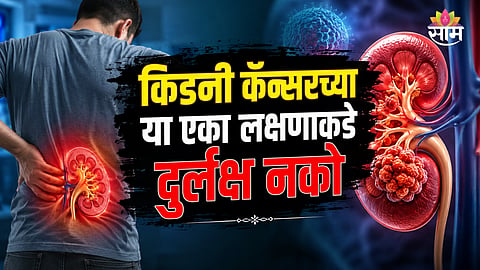 Kidney Cancer