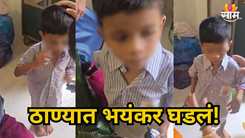 THANE CHILD ABUSE CASE: MOTHER ACCUSED OF TORTURING 3.5-YEAR-OLD SON, POLICE INVESTIGATION UNDERWAY