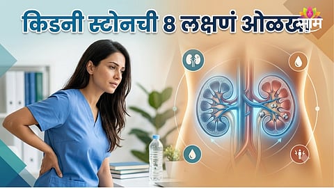 Kidney stone symptoms
