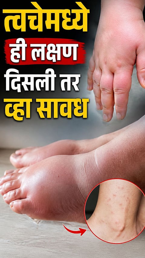  Diabetes Skin Signs And Symptoms