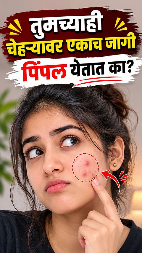 WHY DO PIMPLES KEEP APPEARING IN THE SAME SPOT? CAUSES, SYMPTOMS AND PREVENTION TIPS