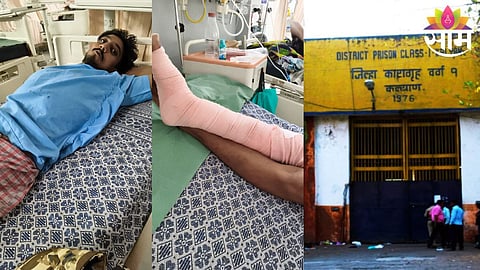 Injured inmate undergoing treatment at JJ Hospital after alleged assault by jail staff in Kalyan Adharwadi Jail.