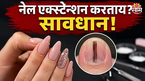 Black Line Under Nail