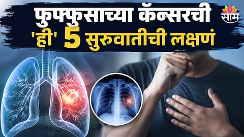 Lung Cancer Stage 1