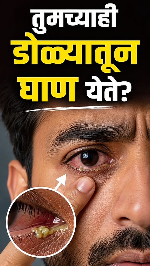 EYE CARE TIPS: HOW TO KEEP YOUR EYES CLEAN, HEALTHY AND PROTECTED