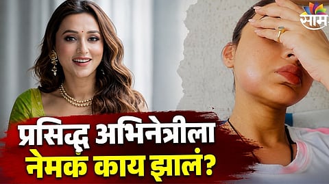 Actress Injured