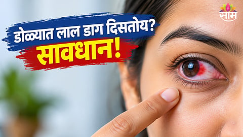 Blood spot in eye causes