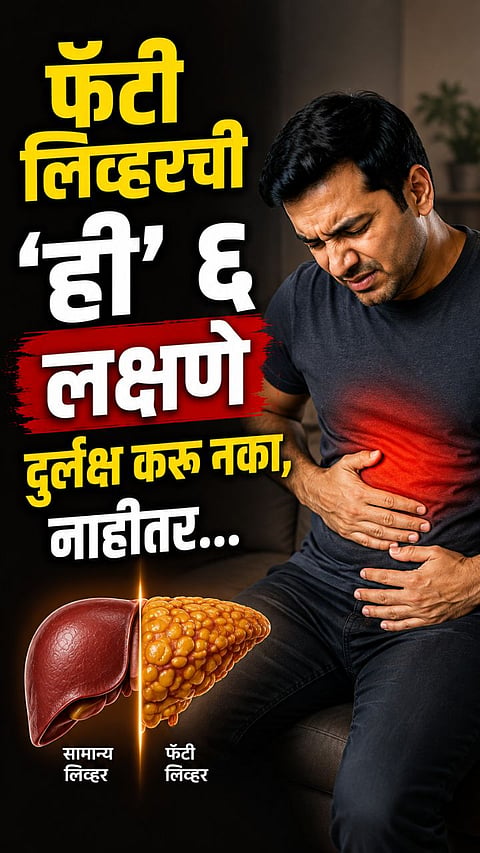 Fatty Liver Symptoms