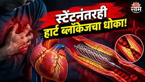 Heart stent blockage