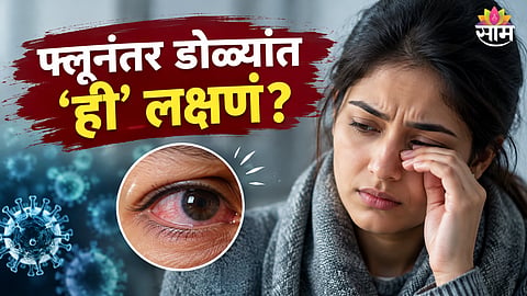 H1N1 eye symptoms