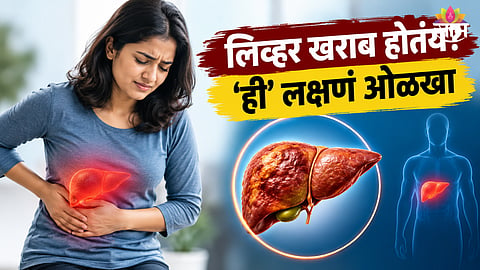 Liver Transplant Signs