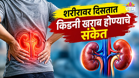 Kidney Disease