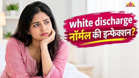 Vaginal discharge
