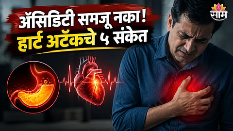 Heart attack
