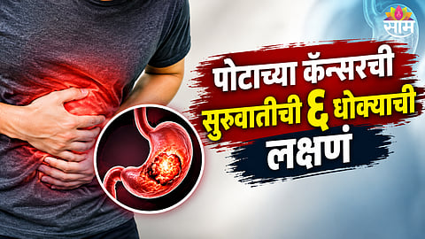 Gastric cancer symptoms