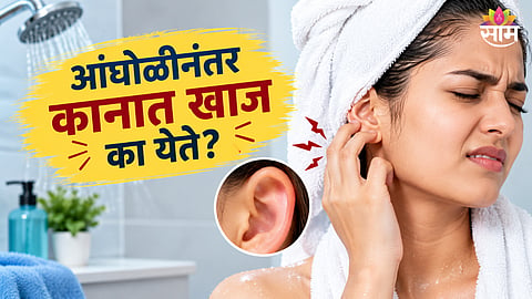 Itchy ears after bathing
