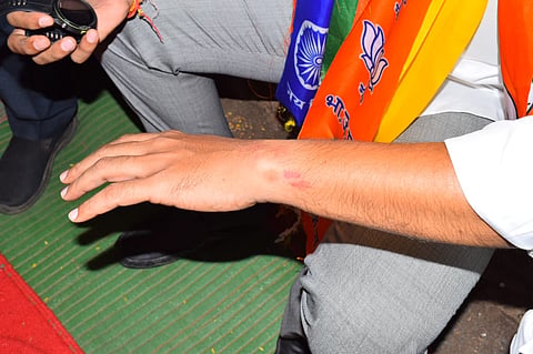 Attack on MP Omraje Nimbalkar 
