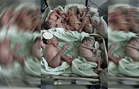 5 babies birth at a time