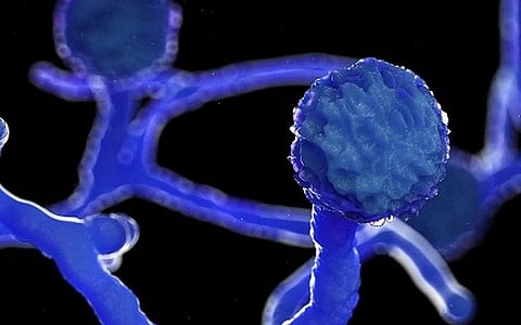 mucormycosis_1.jpg