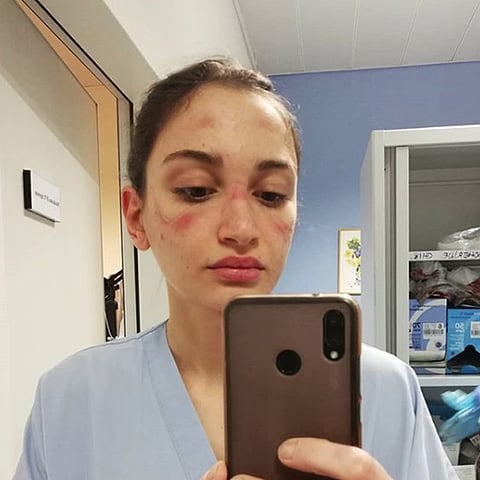 viral satya corona virus health workers exhausted italy nurse