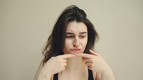 pimple treatment