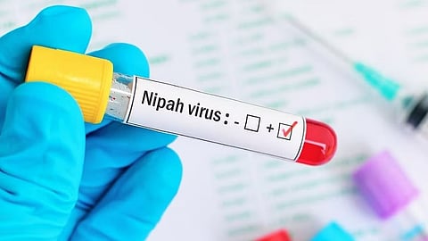 NIPAH VIRUS