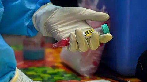 Nipah virus