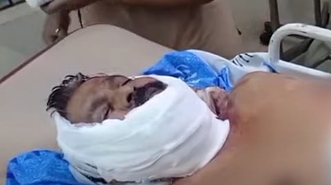 Woman's attempt to kill her husband in Kollam