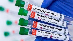 M POX 