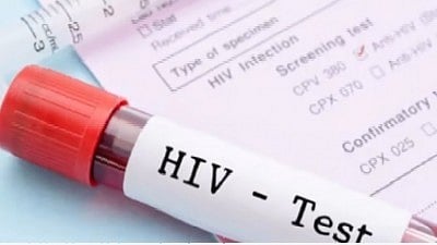 HIV infection