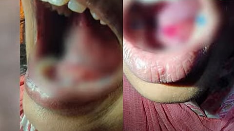 Dental treatment