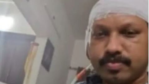 hair transplant