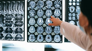 Doctor scanning x-ray