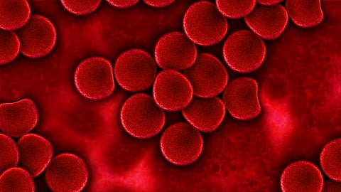 'We know how to cure sickle cell disease'
