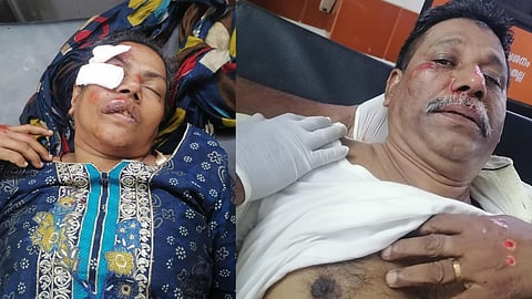 Jail superintendent and wife injured after falling into a pothole on the road