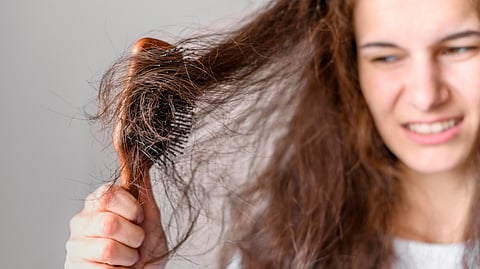 Hair fall