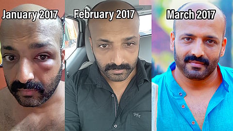 M B Padmakumar