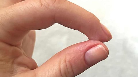 super glue