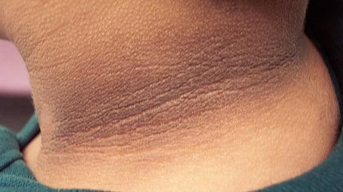 black neck