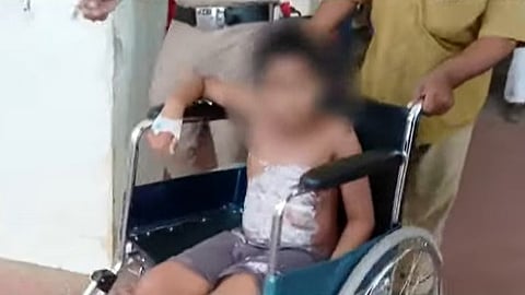 Child burn