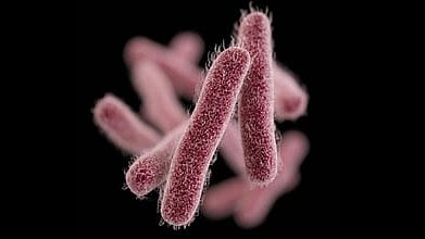 Shigella Outbreak