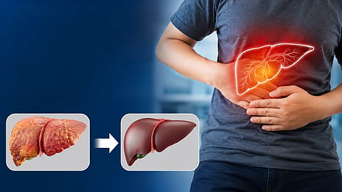 Fatty Liver Symptoms